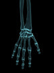 radiograph hand Wall Mural