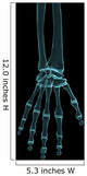 radiograph hand Wall Mural