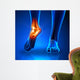 Ankle Pain Detail