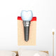 Dental implant in jaw bone Wall Decal
