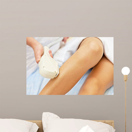 Laser Epilation