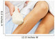 Laser Epilation