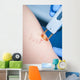 Varicose Veins Laser Cosmetics