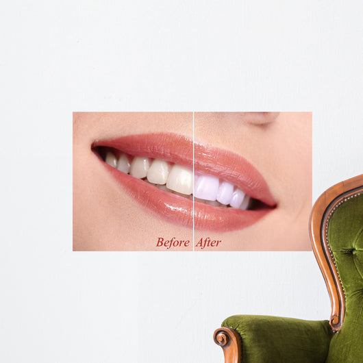 Woman Smiling with Teeth