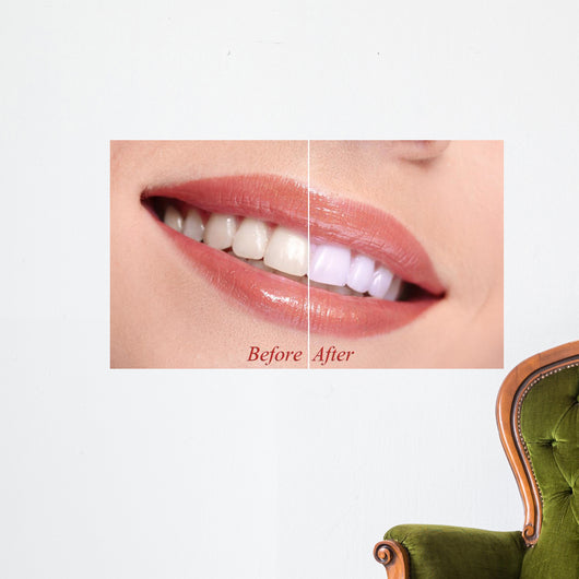 Woman Smiling with Teeth