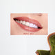 Woman Smiling with Teeth