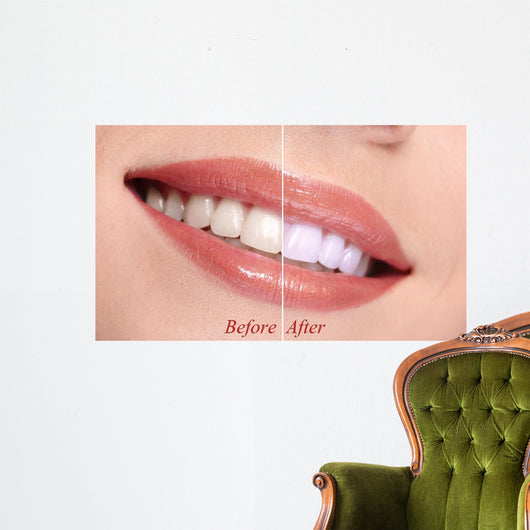 Woman Smiling with Teeth
