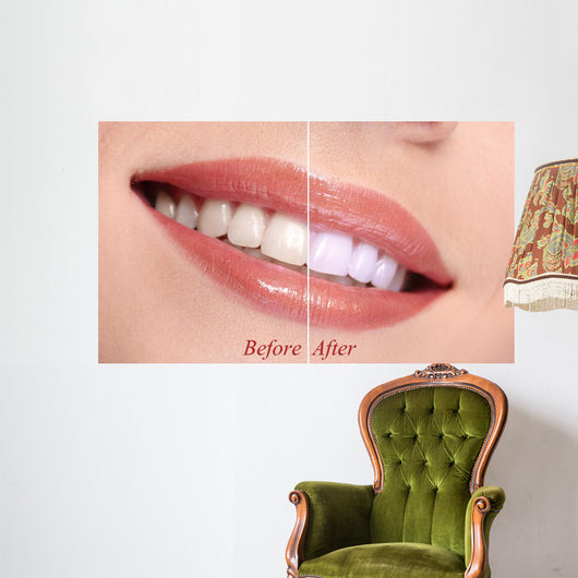 Woman Smiling with Teeth