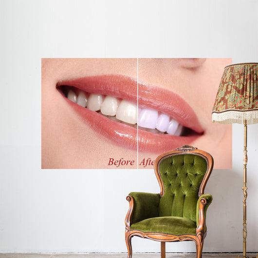 Woman Smiling with Teeth
