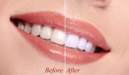 Woman Smiling with Teeth