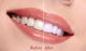 Woman Smiling with Teeth