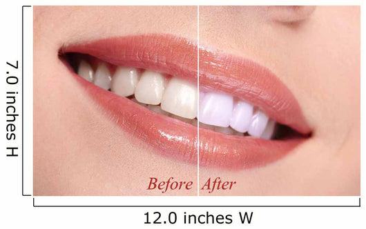 Woman Smiling with Teeth