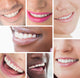 Collage White Smiles