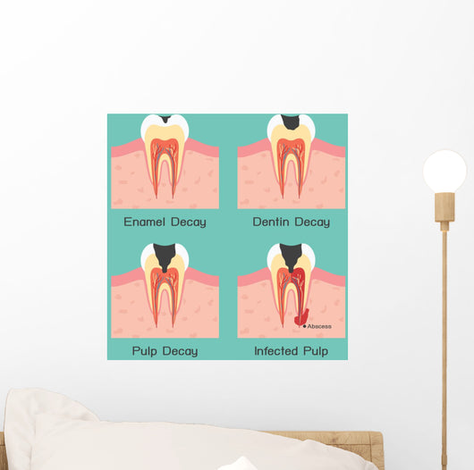 Tooth Decay Wall Mural
