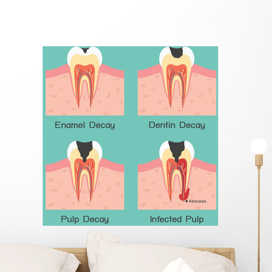 Tooth Decay Wall Mural