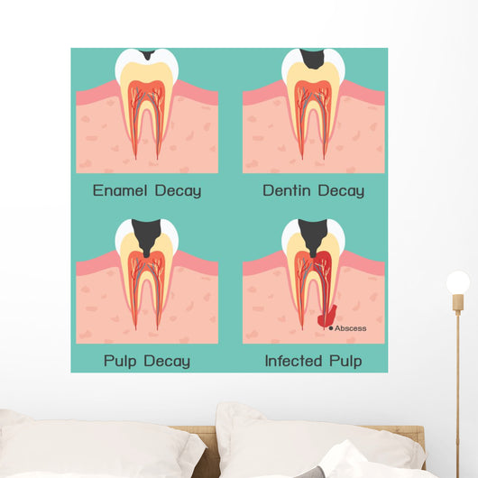 Tooth Decay Wall Mural