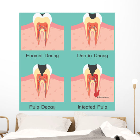 Tooth Decay Wall Mural