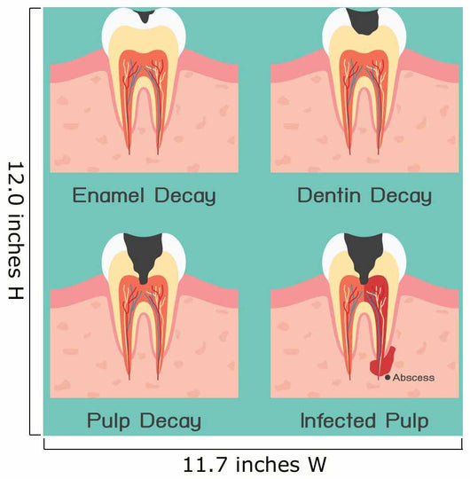 Tooth Decay Wall Mural