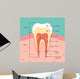 Tooth Anatomy Wall Mural