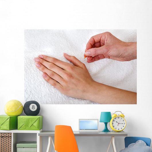 Alternative Practitioner Applying Acupuncture Needles. Wall Mural