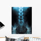 x-ray of a young male spine Wall Mural