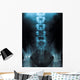 x-ray of a young male spine Wall Mural