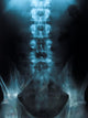 x-ray of a young male spine Wall Mural