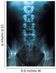x-ray of a young male spine Wall Mural