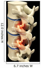 Human Spine