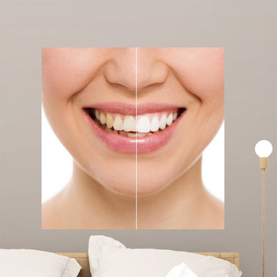 Before and after Bleaching Wall Decal shown on a wall