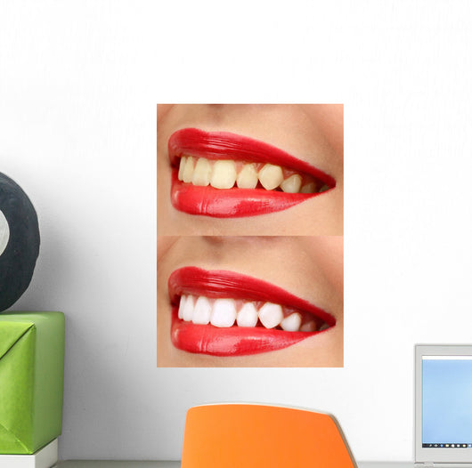 Women Smile with Teeth - Red Lipstick Wall Decal
