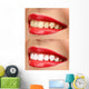 Women Smile with Teeth - Red Lipstick Wall Decal