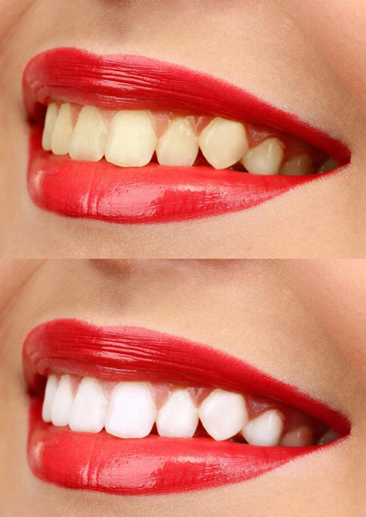 Women Smile with Teeth - Red Lipstick Wall Decal