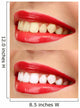 Women Smile with Teeth - Red Lipstick Wall Decal