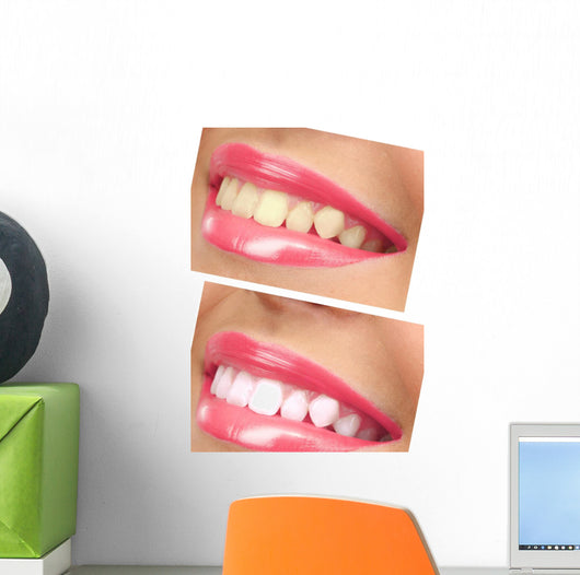 Women Smile with Teeth - Pink Lipstick Wall Decal