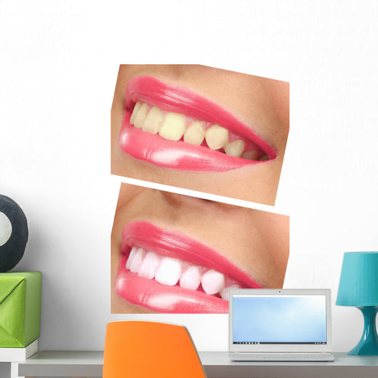 Women Smile with Teeth - Pink Lipstick Wall Decal