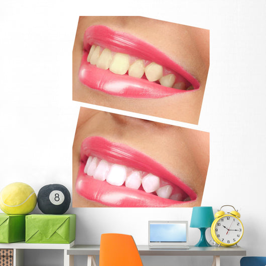 Women Smile with Teeth - Pink Lipstick Wall Decal