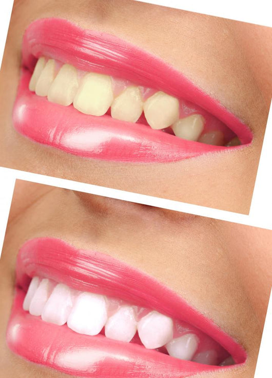 Women Smile with Teeth - Pink Lipstick Wall Decal