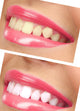 Women Smile with Teeth - Pink Lipstick Wall Decal