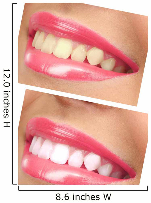 Women Smile with Teeth - Pink Lipstick Wall Decal