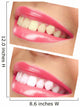 Women Smile with Teeth - Pink Lipstick Wall Decal