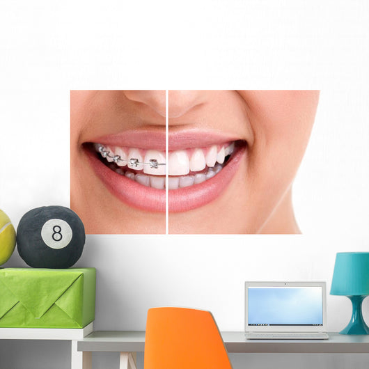 Healthy Smile with Braces Wall Decal