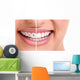 Healthy Smile with Braces Wall Decal