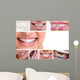 Dental Braces Wall Decal