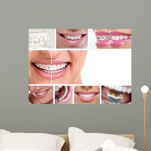 Dental Braces Wall Decal