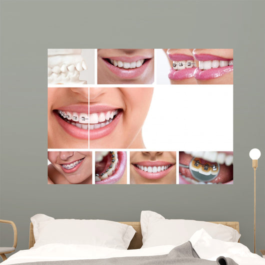 Dental Braces Wall Decal
