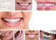 Dental Braces Wall Decal