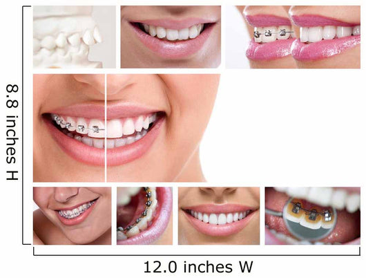 Dental Braces Wall Decal