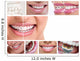 Dental Braces Wall Decal