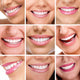 Teeth Collage People Smiles Wall Decal